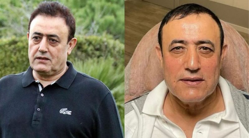 Mahmut Tuncer estetik operasyon geçirdi İşte ünlü şarkıcının son hali! 1