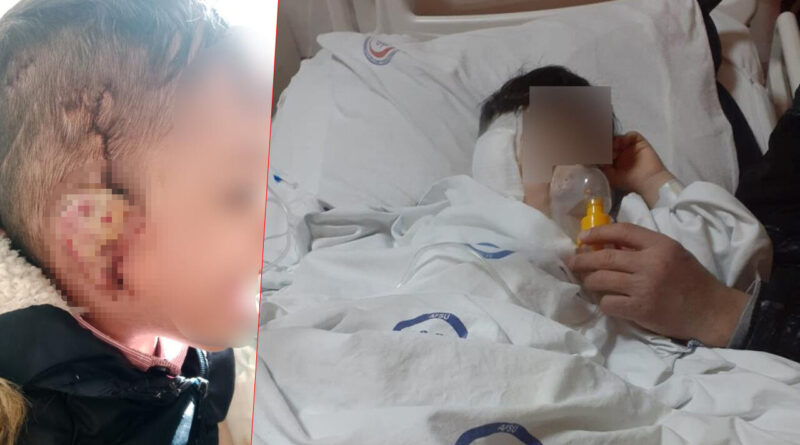 2 ayda 7 ameliyat olan çocuğun kulağı çürüdü! 1