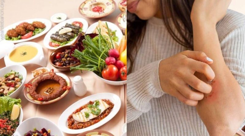 Açık alanlarda yemek yiyenler dikkat! Uzmanlar uyardı: "Ölümle sonuçlanabiliyor" 7