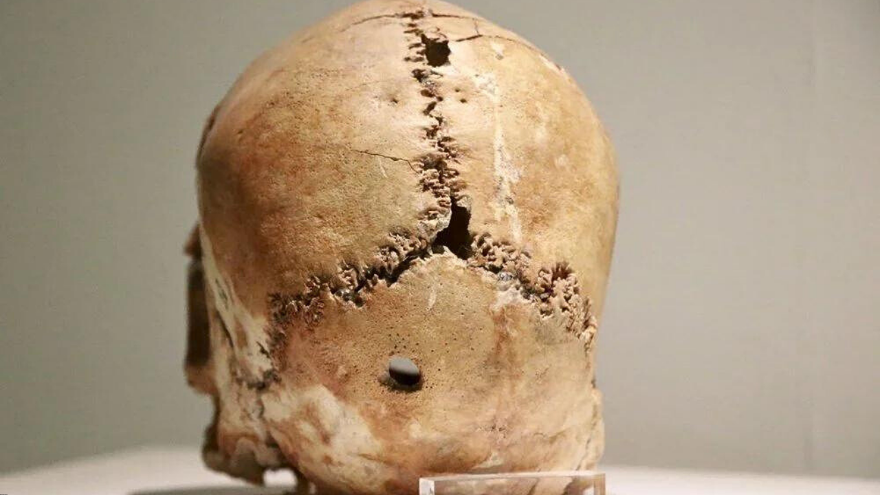 İlk beyin ameliyatının kafatası bulunan Aşıklı Höyük Aksaray’da yer alıyor