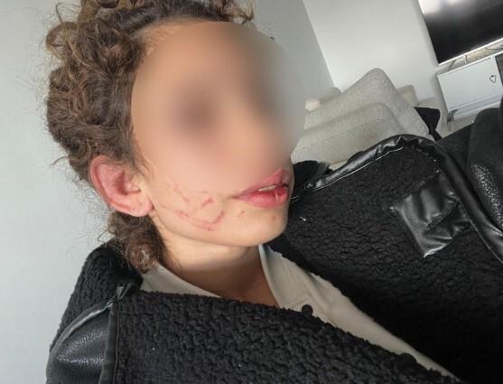 Konya'da Üniversite Öğrencisi 24 Yaşlı Adam Tar Bölmüş, Şüpheli Adli Kontrol Şartıyla Serbest Bırakıldı 1
