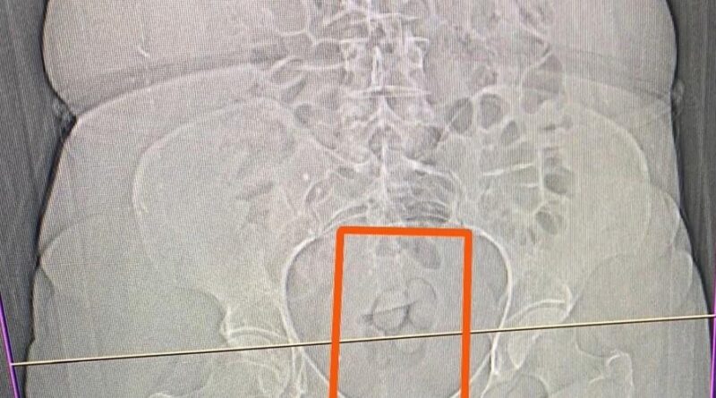 Erzincan'da Uyuşturucu Ticaretiyle Mücadele Sonucu 4 Şahıs Yakalandı 1