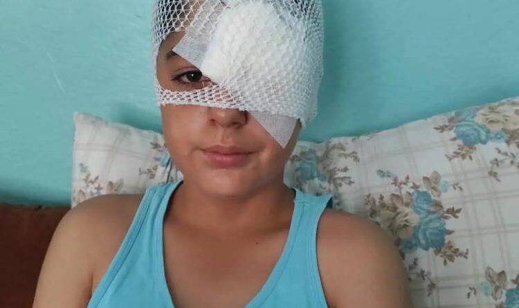 Şanlıurfa'da köpek saldırısından kaçan çocuğa otomobil çarptı 1