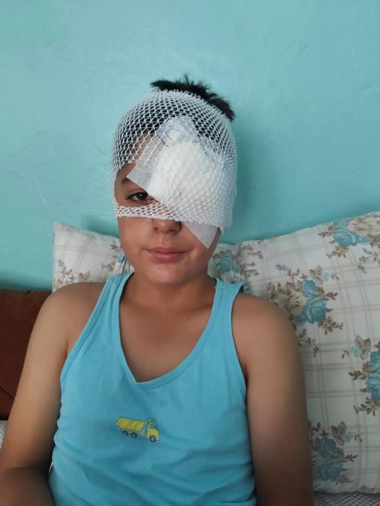 Şanlıurfa’da köpek saldırısından kaçan çocuğa otomobil çarptı