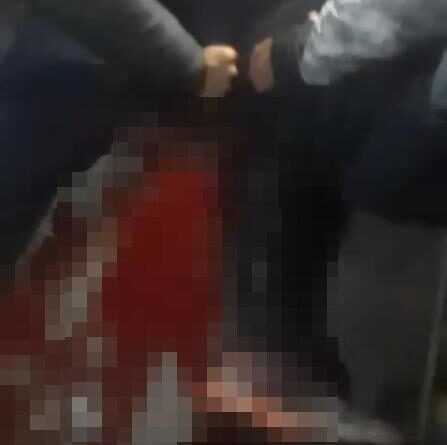 Üsküdar'da bıçaklı kavga : 1 yaralı 1